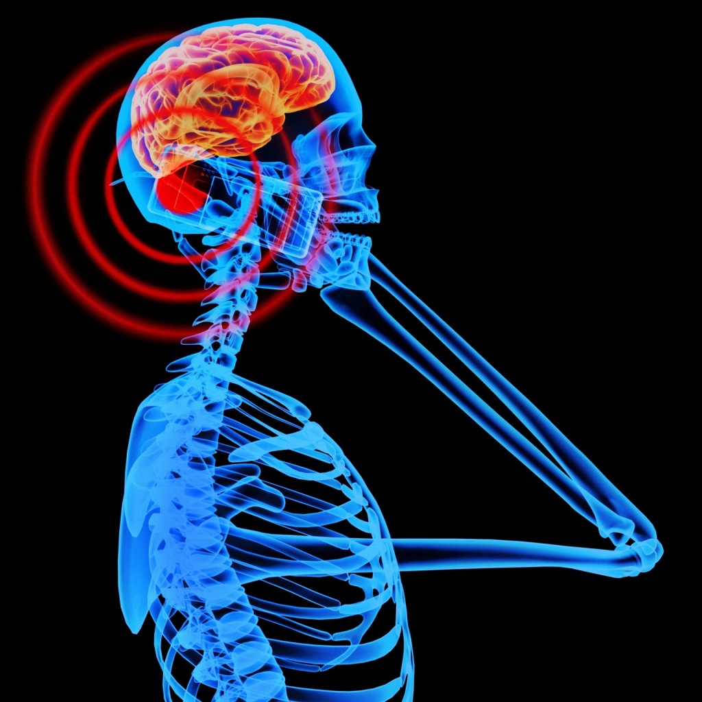 Mobile Phone Radiation